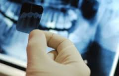 radiologia - Diferencia entre radiología digital y placa radiográfica