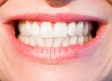 ¿Por qué optar por un implante dental?