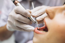 paciente siendo intervenida por un dentista.